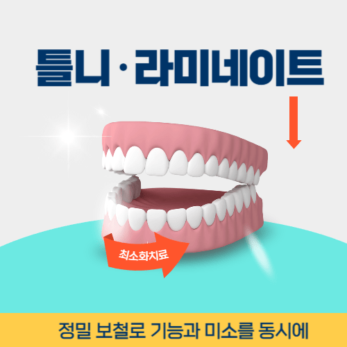 제주치과 제주시 치과 틀니 라미네이트