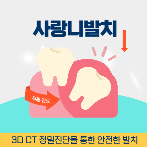 제주치과 제주시 치과 사랑니 발치