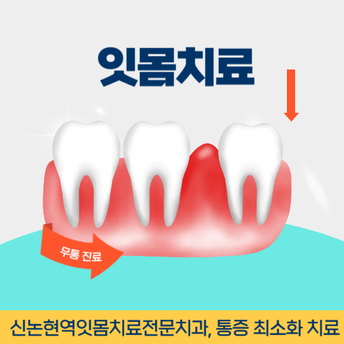 제주치과 제주시 치과 잇몸치료